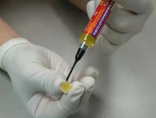 所谓的 美牙师 ,还要坑害多少人